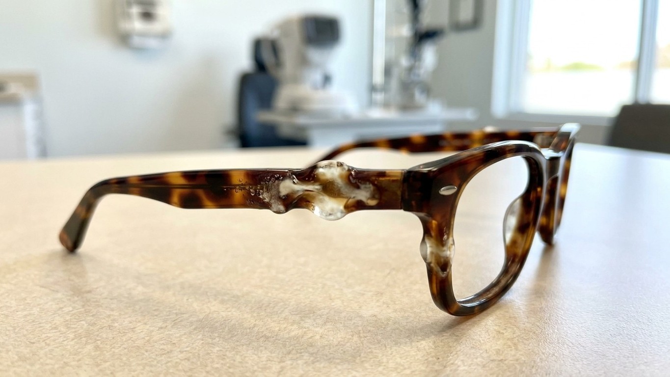 « Je pensais que le spray anti-moustiques ne touchait que ma peau » : chez l'opticien, on m'a expliqué ce qui avait mangé ...