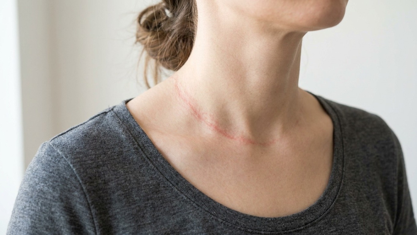 « Je pensais que ma chaîne était simplement sale » : pourquoi ce liseré rosé apparu au creux du cou ne part plus jamais
